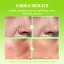 2-Step Cooling & V-Lift Duo